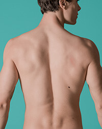 Depilação a laser na região das costas masculina e feminina